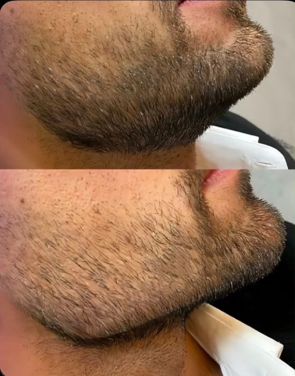 مرکز لیزر رولا