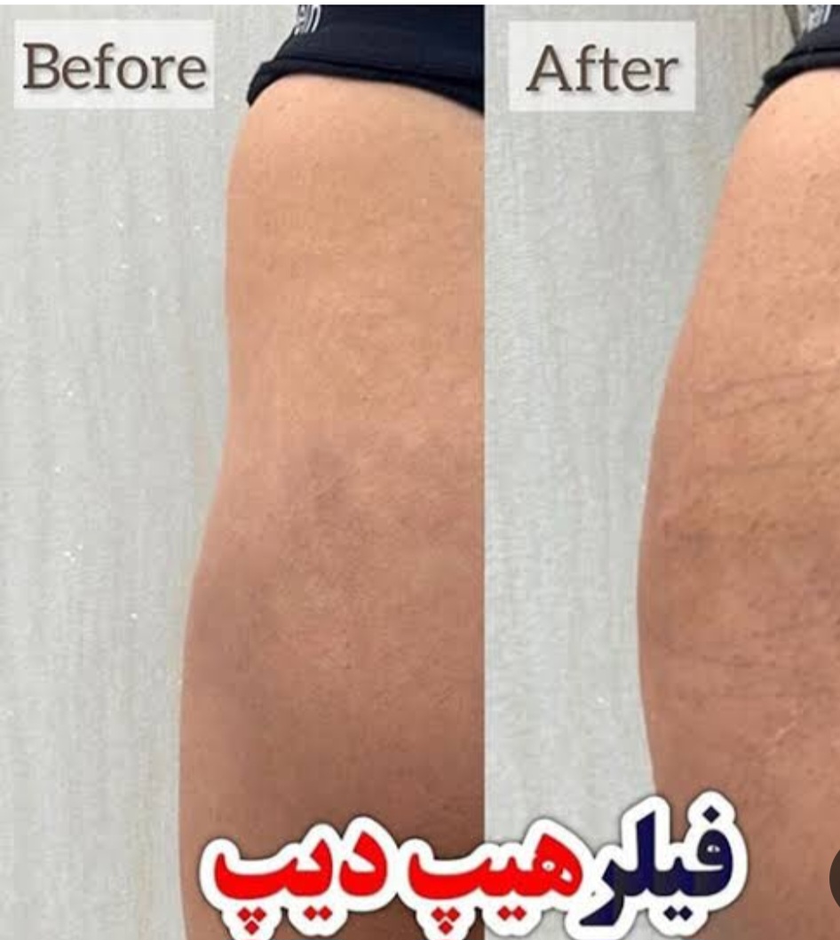 تصویر محیط لابیوپلاستی و زیبایی زنان در غرب تهران