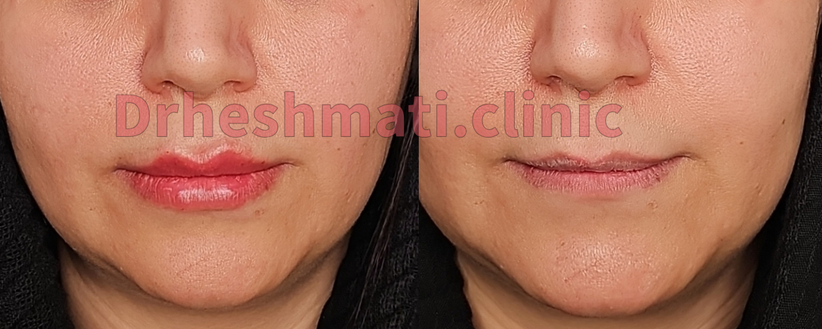 تصویر محیط کلینیک پوست مو زیبایی دکتر حشمتی