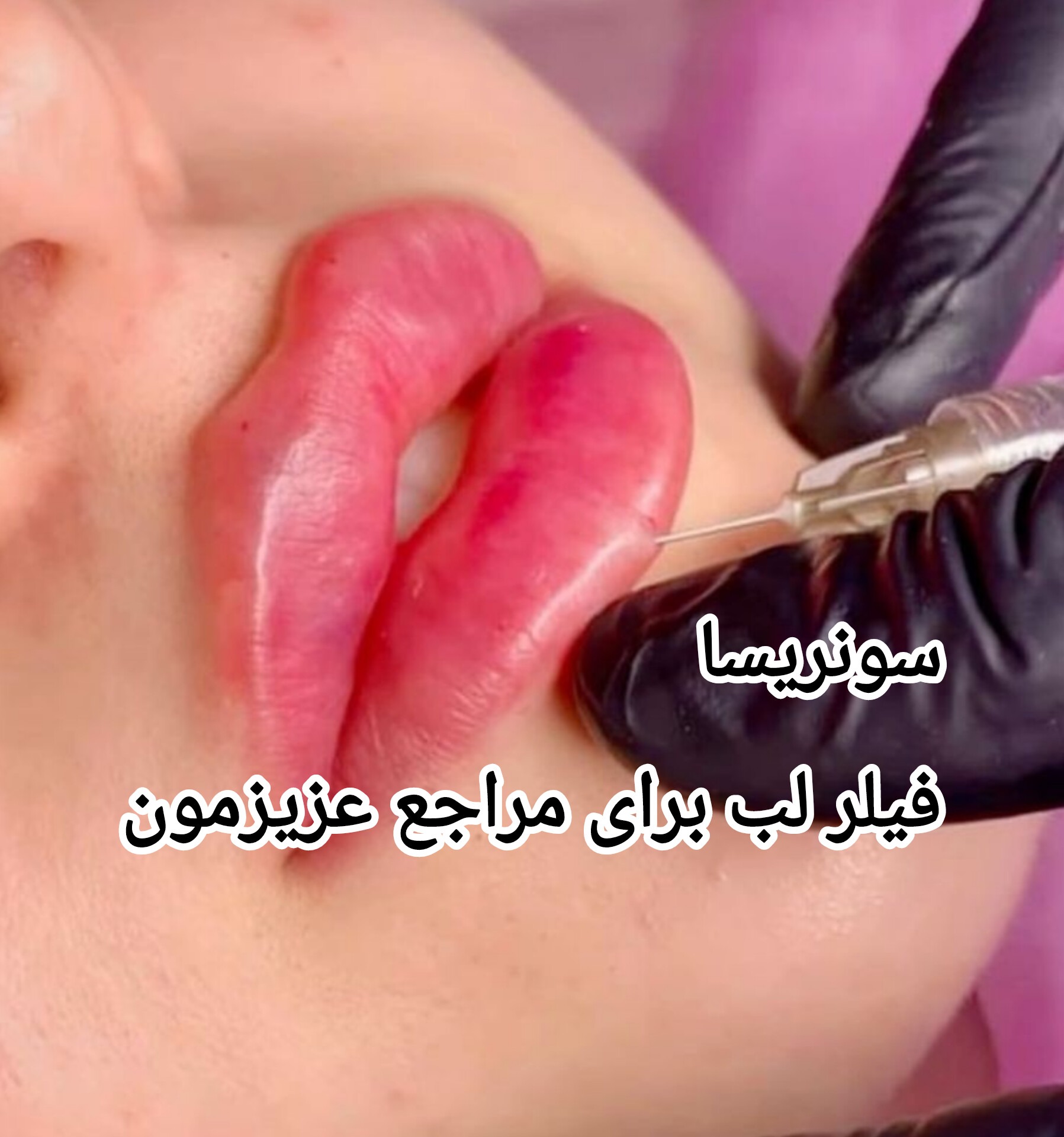 تصویر محیط مرکز لیزر و کلینیک زیبایی سونریسا