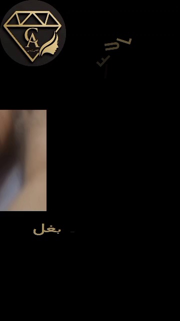 تصویر محیط کلینیک زیبایی و لیزر الماس زیبایی