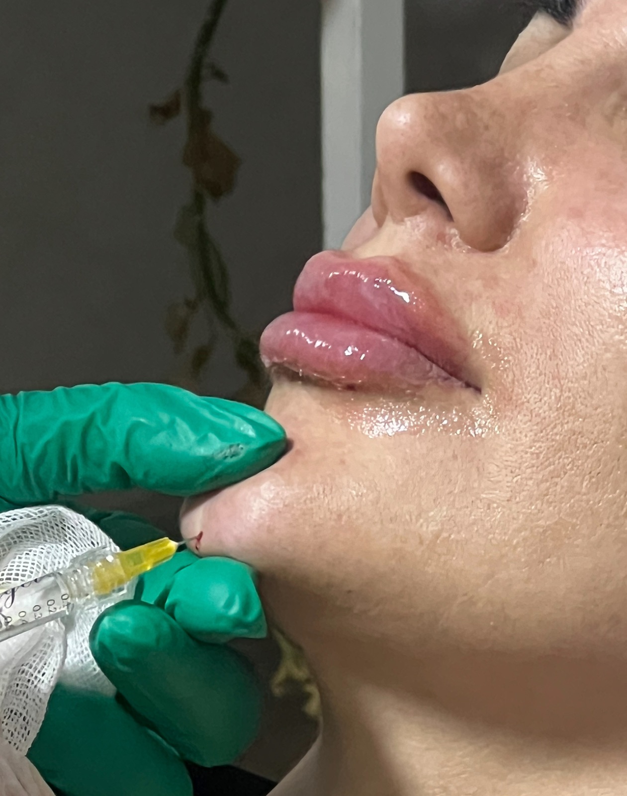تصویر محیط مرکز زیبایی و لیزر شادیم