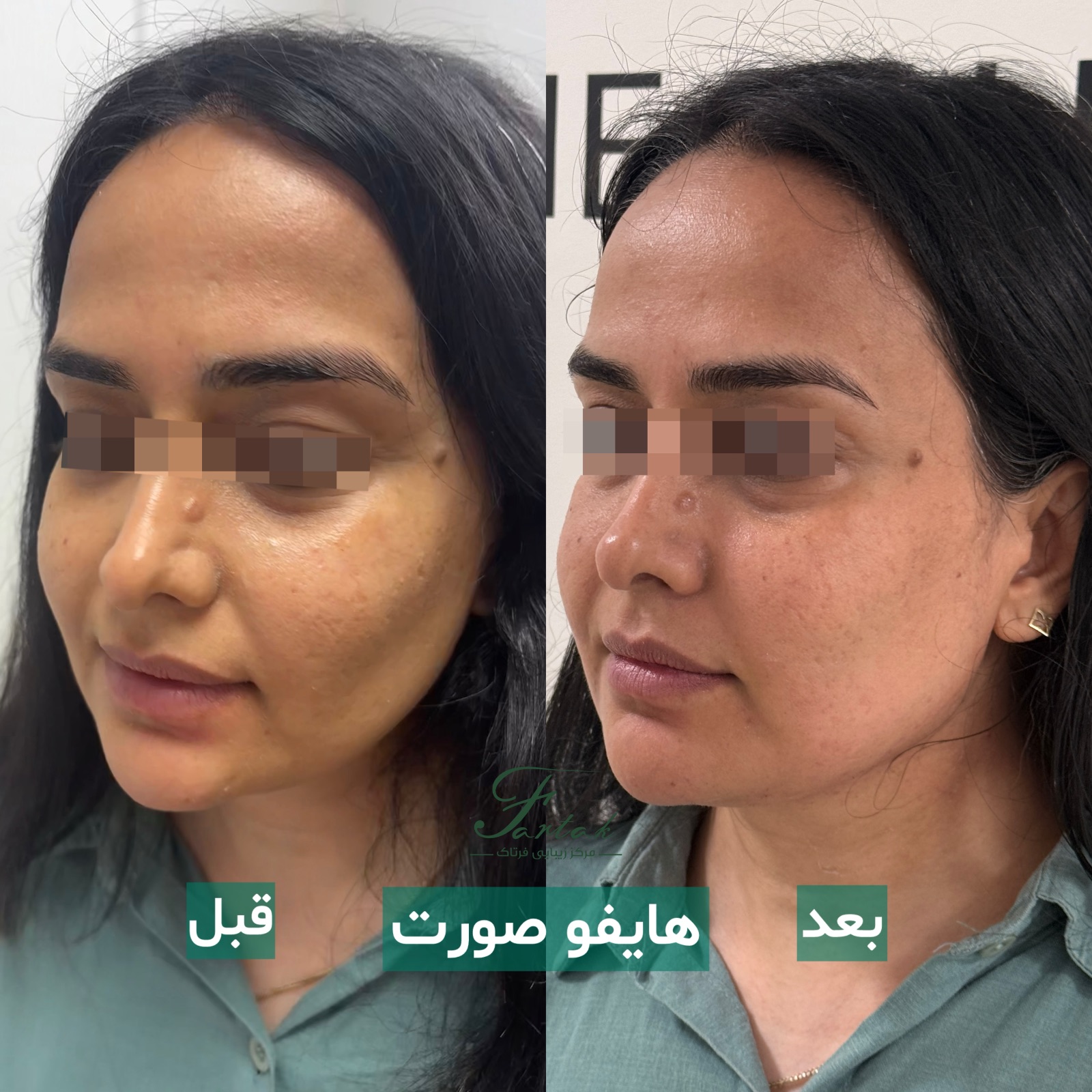 تصویر محیط کلینیک زیبایی فرتاک