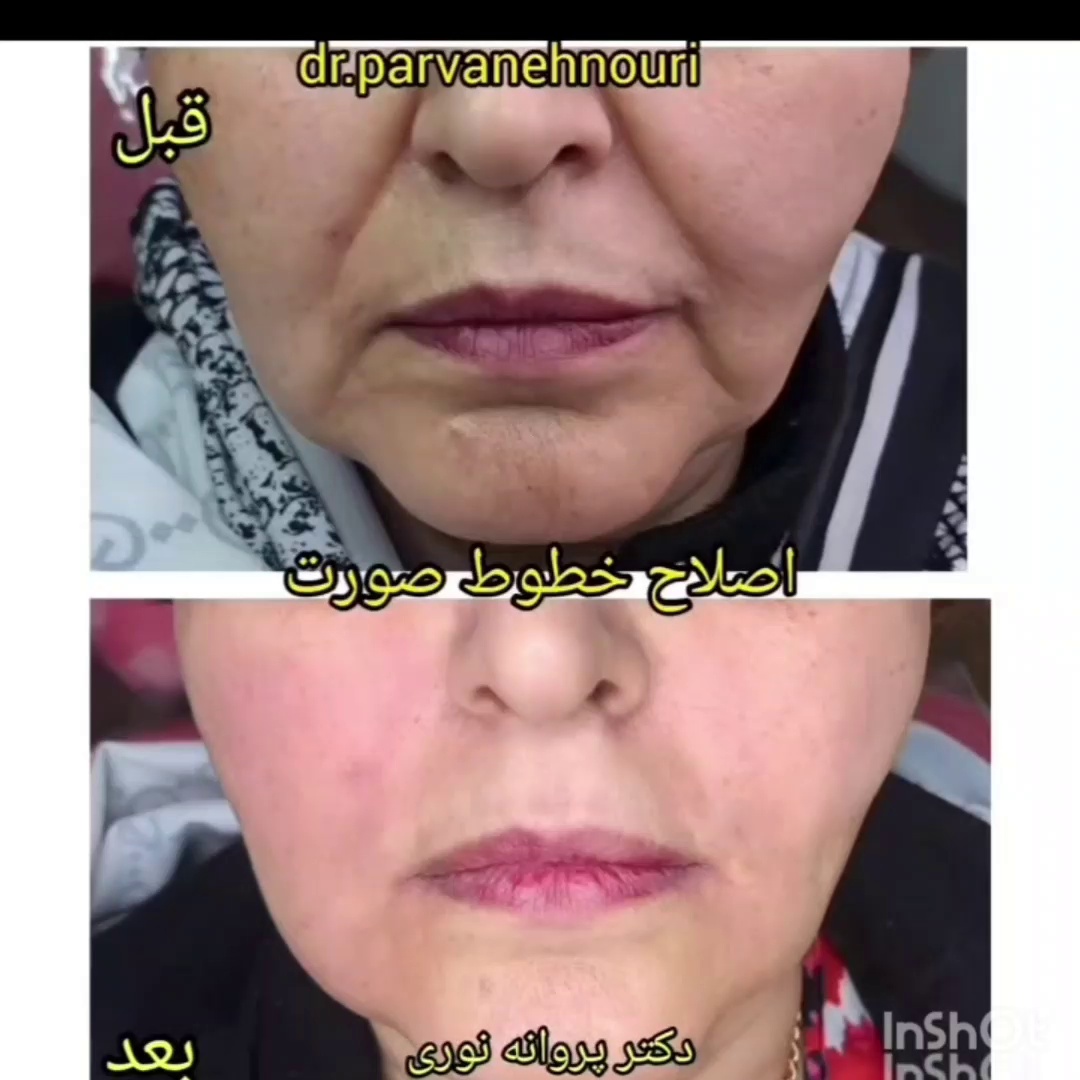 تصویر محیط کلینیک زیبایی مرکز لیزر دکترپروانه نوری