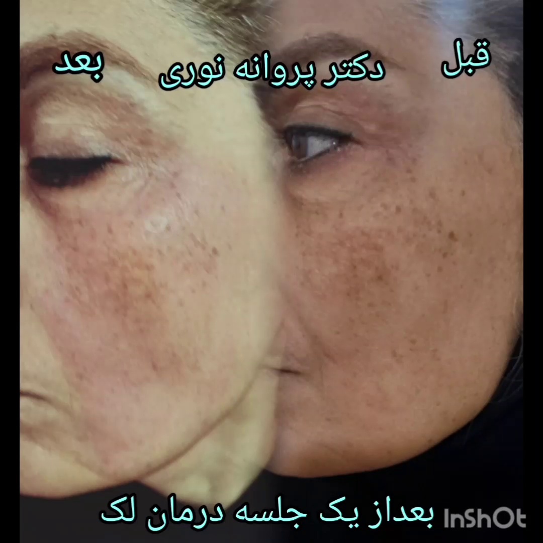 تصویر محیط کلینیک زیبایی مرکز لیزر دکترپروانه نوری