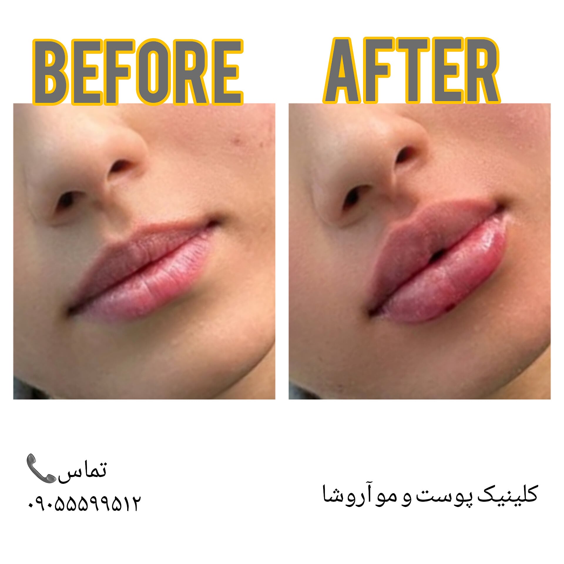 تصویر محیط مرکز زیبایی,بوتاکس و لیزر آروشا
