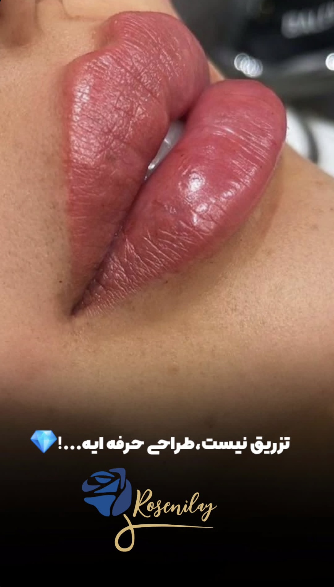 تصویر محیط مرکز لیزر کلینیک زیبایی رزنیلای مرزداران