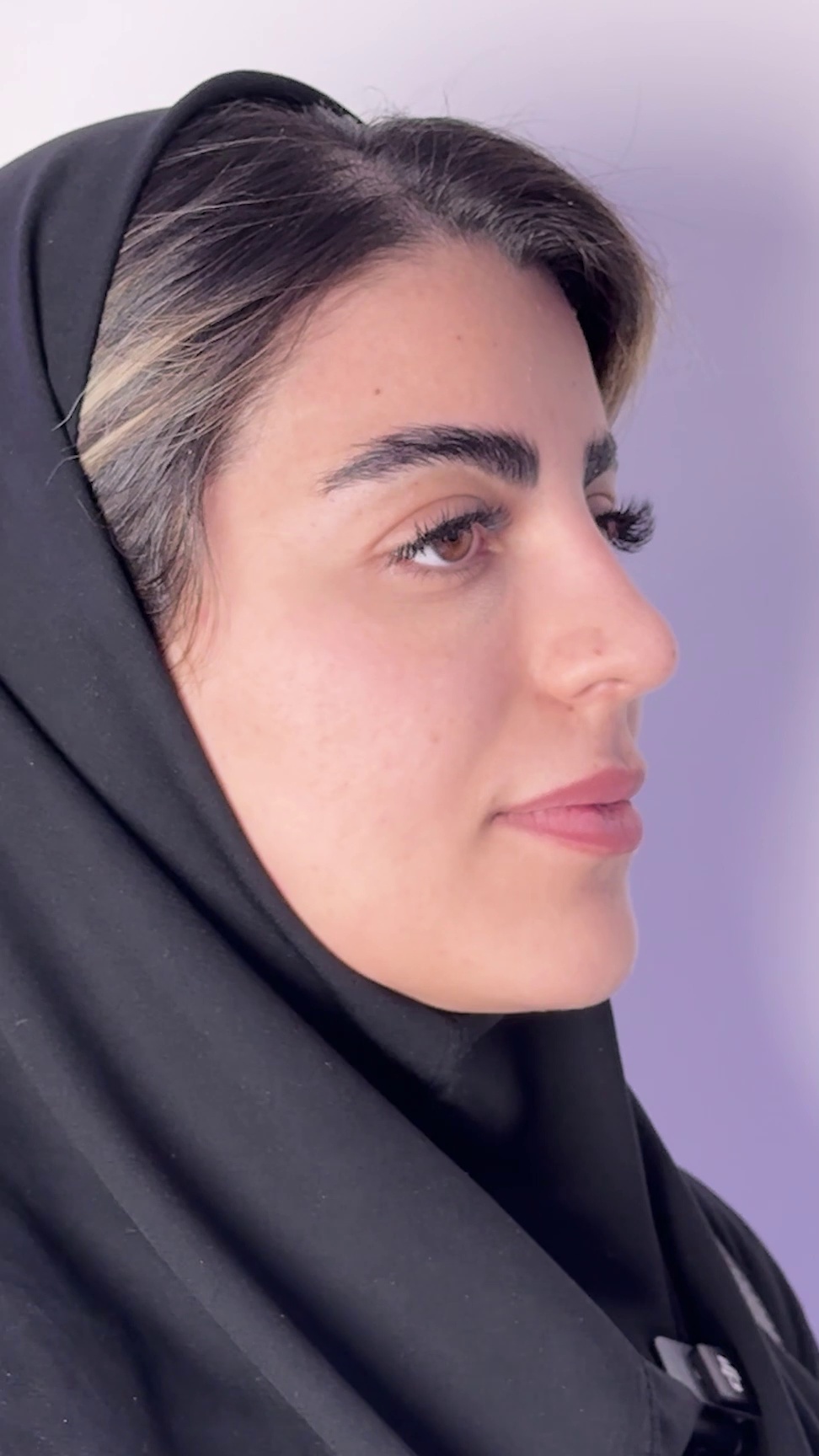 تصویر محیط کلینیک زیبایی،مرکز لیزر الکساندرایت تاژا