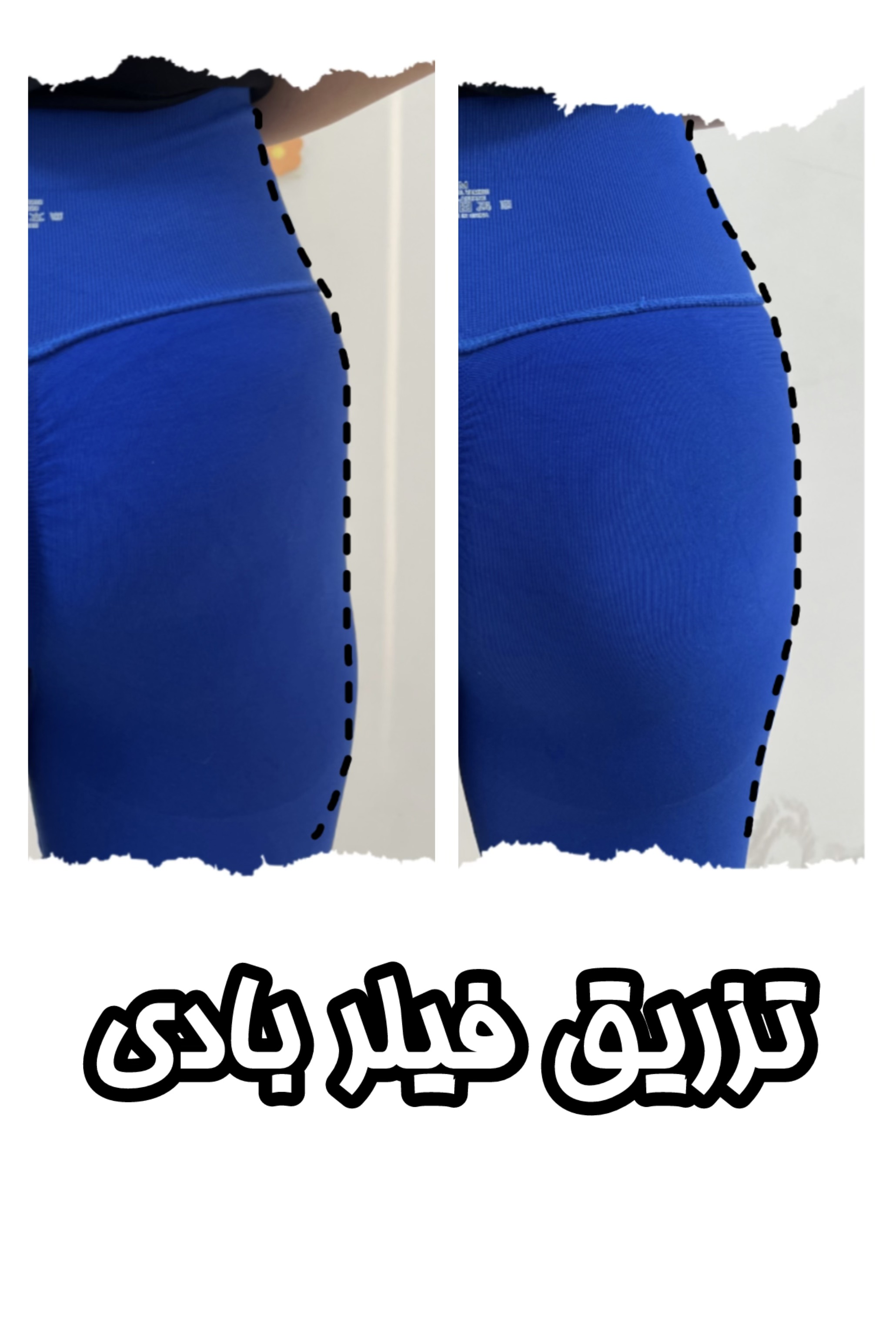 تصویر محیط کلینیک زیبایی هانا(مرکز تخصصی فیلر بادی)