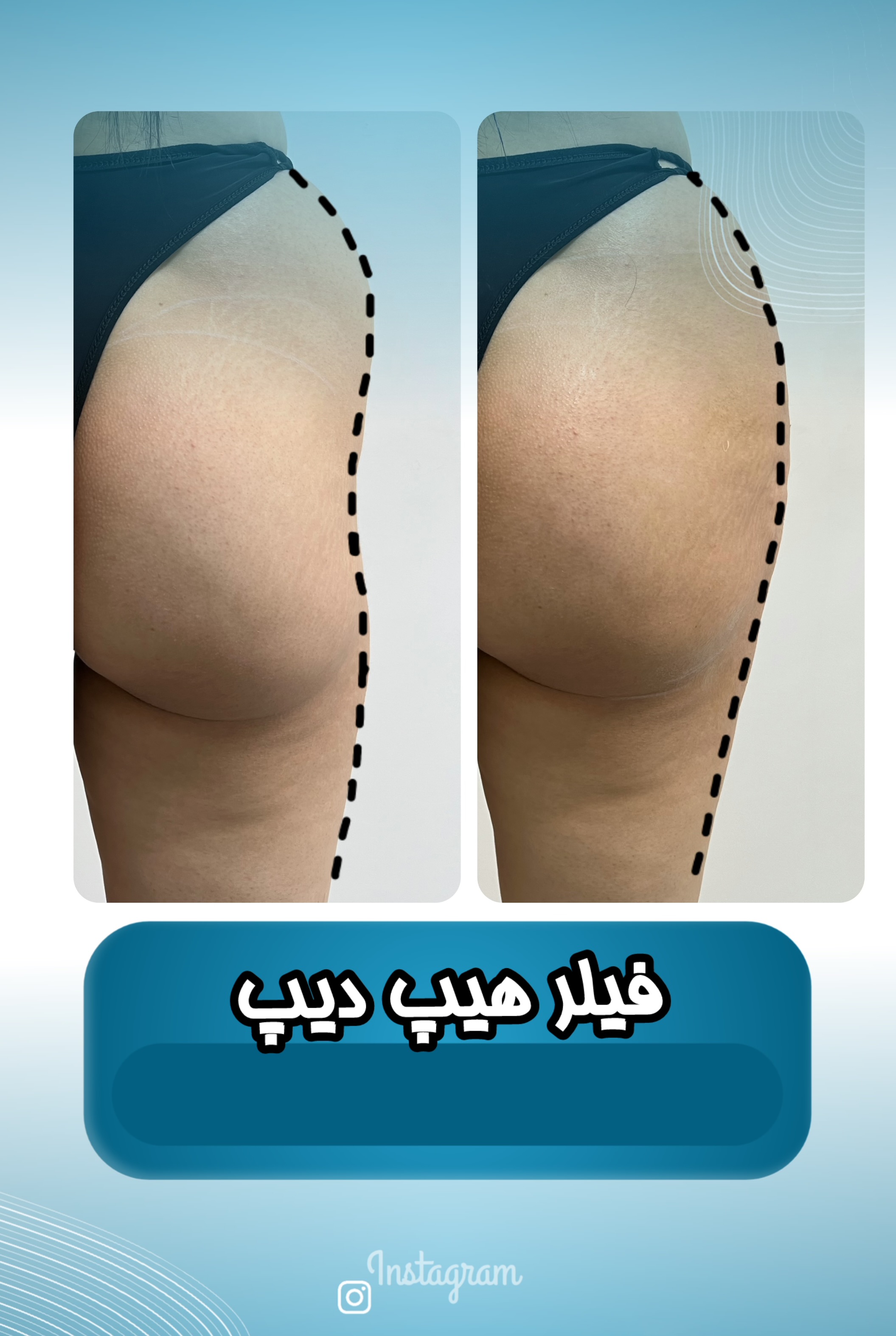تصویر محیط کلینیک زیبایی هانا(مرکز تخصصی فیلر بادی)