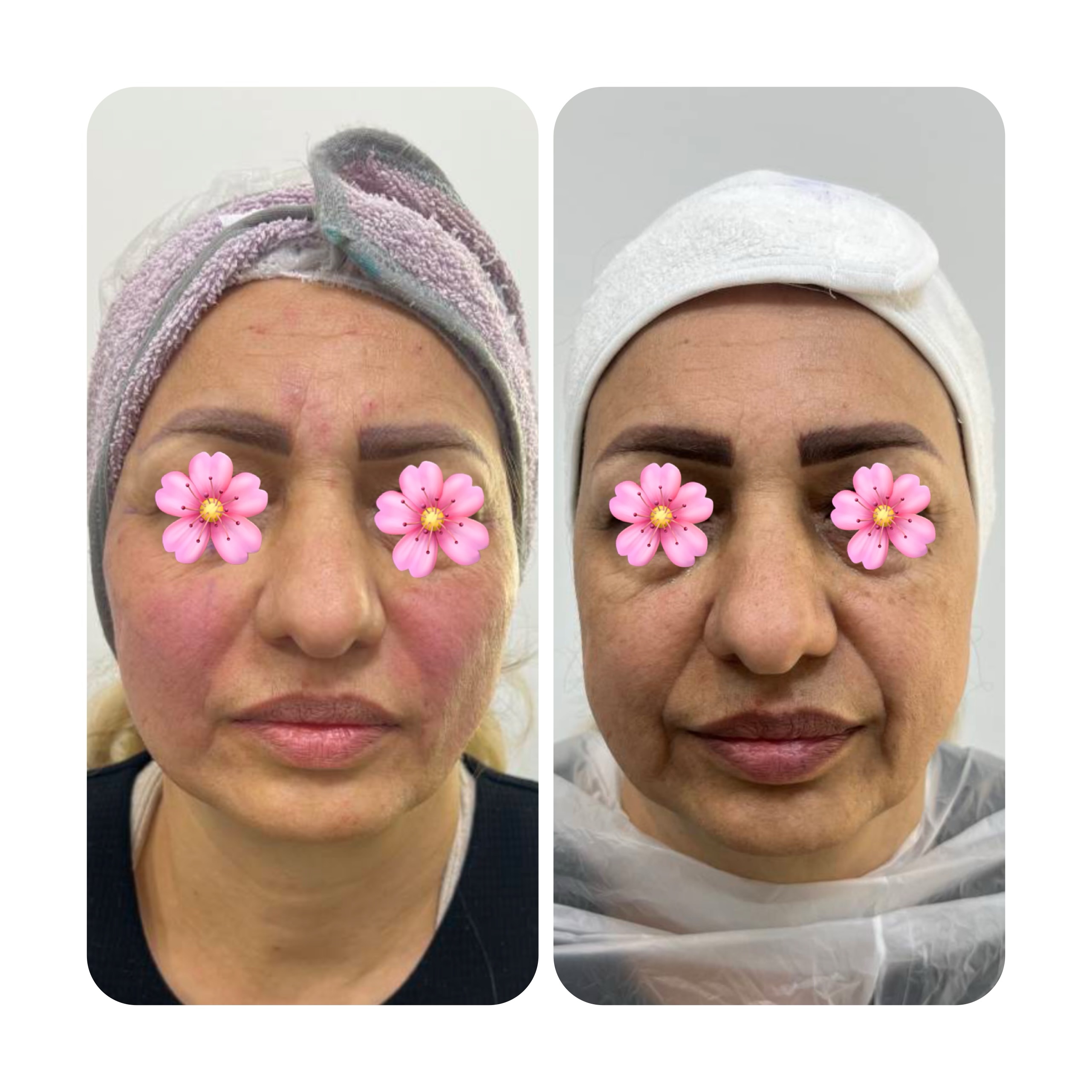 تصویر محیط کلینیک زیبایی هانا(مرکز تخصصی فیلر بادی)