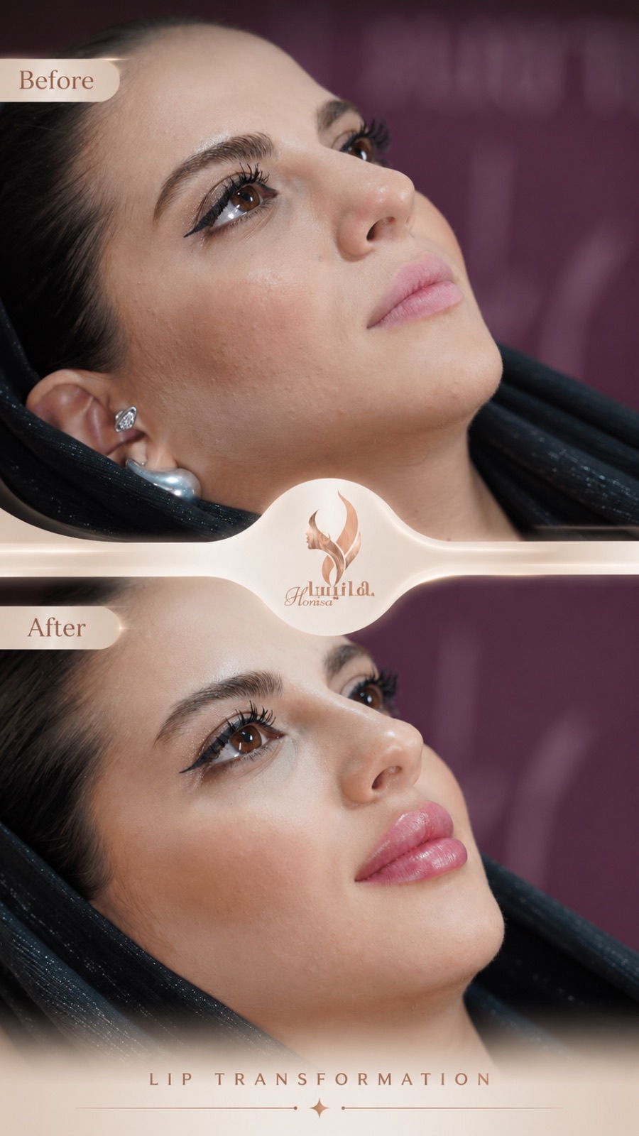 تصویر محیط کلینیک زیبایی و مرکز لیزر هانیسا