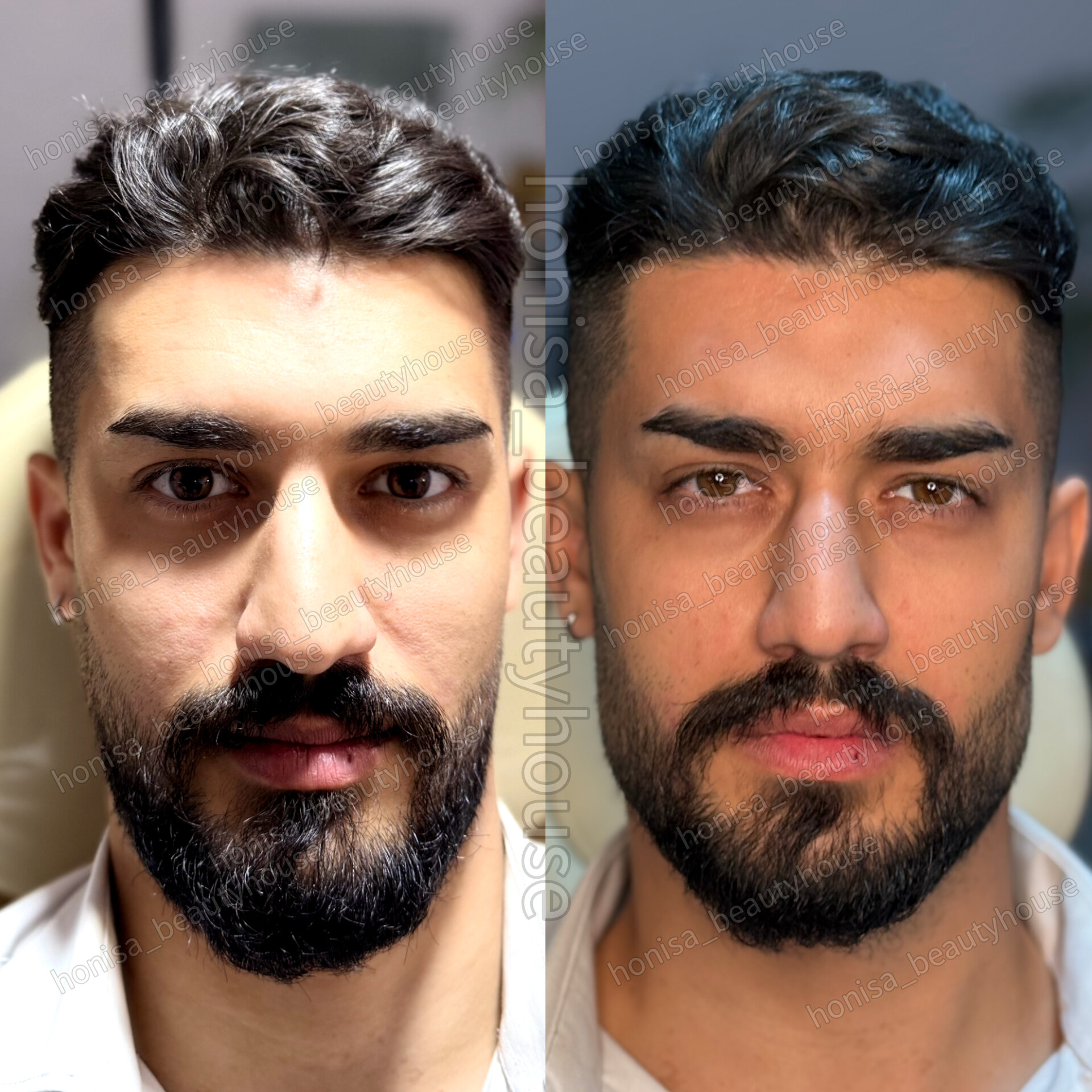تصویر محیط کلینیک زیبایی و مرکز لیزر هانیسا