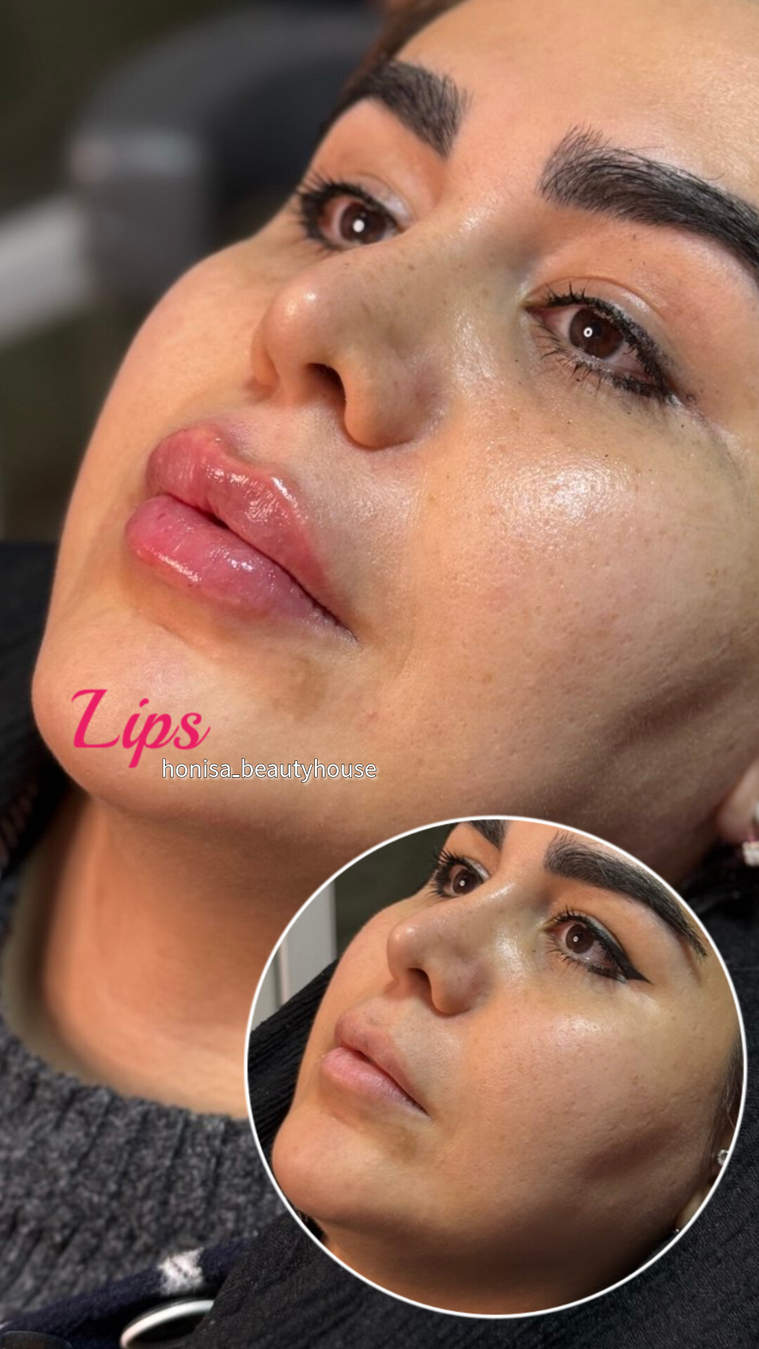 تصویر محیط کلینیک زیبایی و مرکز لیزر هانیسا