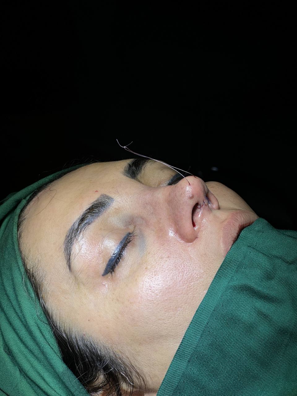 تصویر محیط جراحی زیبایی بینی (دکتر مهدی محمدی)