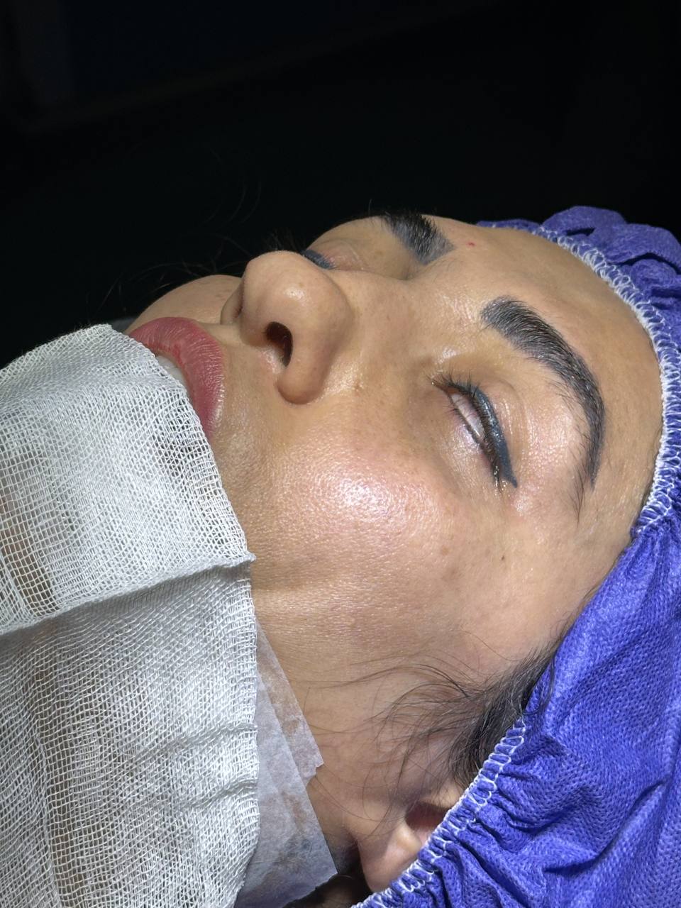تصویر محیط جراحی زیبایی بینی (دکتر مهدی محمدی)