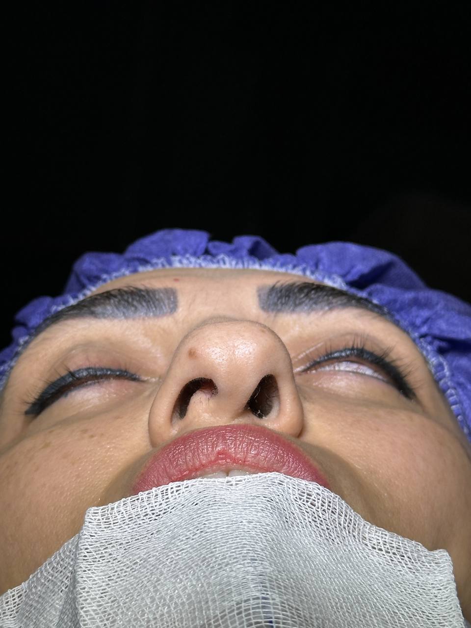 تصویر محیط جراحی زیبایی بینی (دکتر مهدی محمدی)