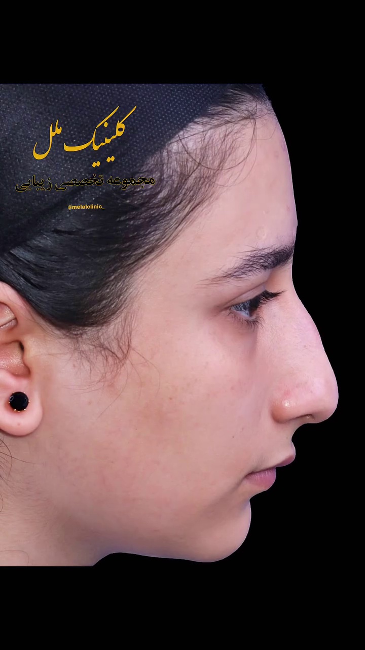 تصویر محیط عمل بینی ملل کلینیک