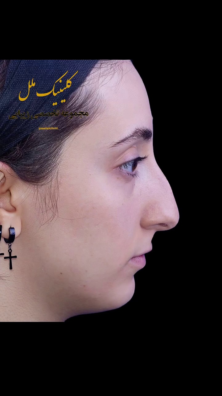تصویر محیط عمل بینی ملل کلینیک
