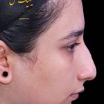 تصویر محیط عمل بینی ملل کلینیک