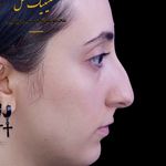 تصویر محیط عمل بینی ملل کلینیک