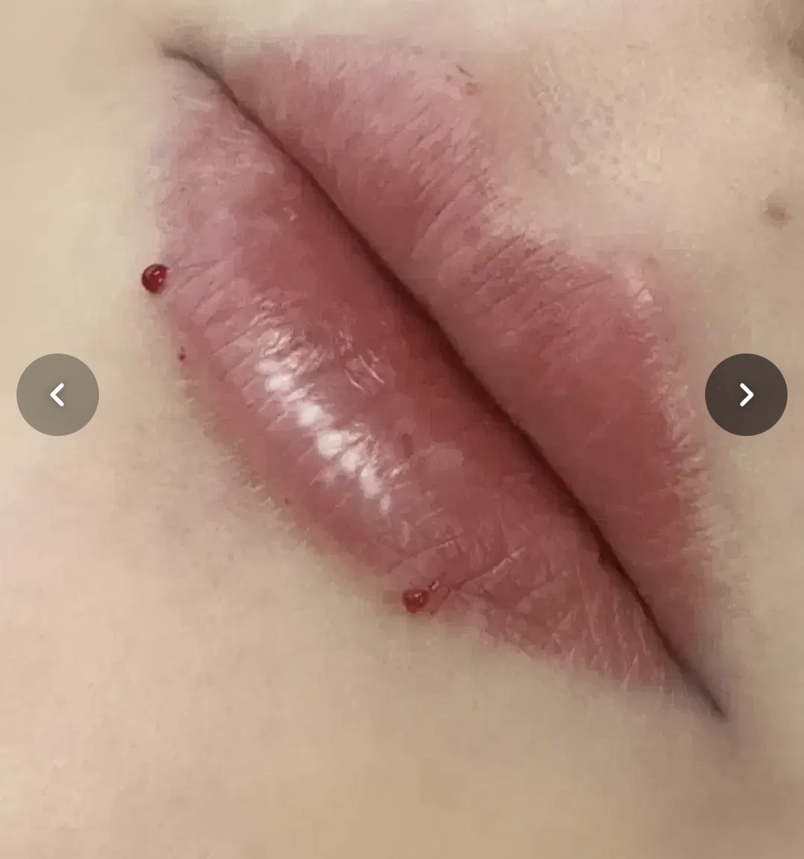 تصویر محیط کلینیک زیبایی و جراحی روزت