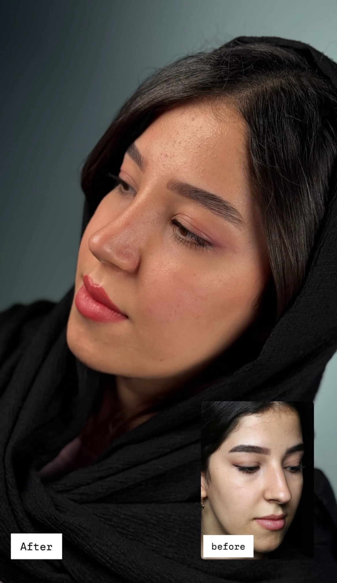 تصویر محیط کلینیک جراحی بینی مینی bini mini