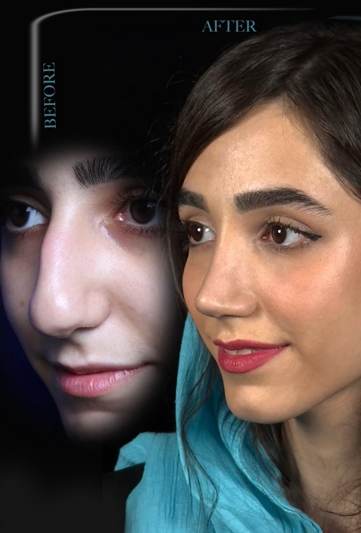 تصویر محیط کلینیک جراحی بینی مینی bini mini