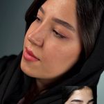 تصویر محیط کلینیک جراحی بینی مینی bini mini