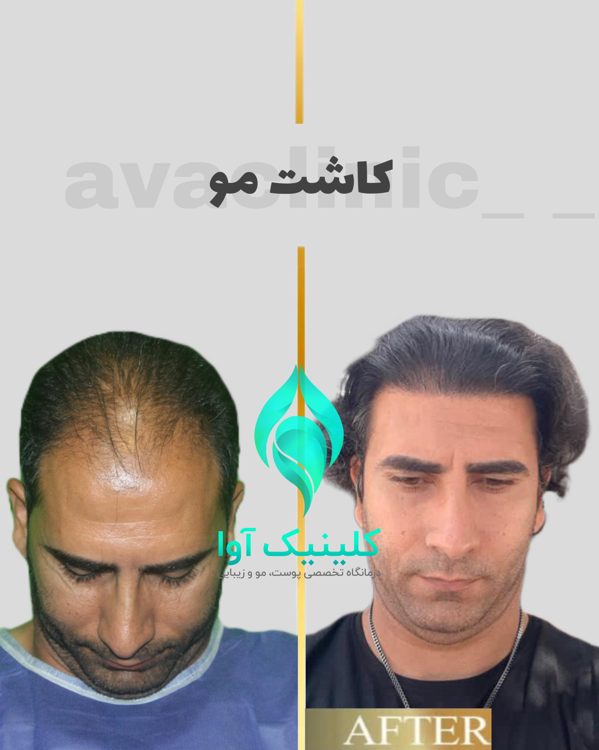 تصویر محیط کلینیک تخصصی پوست و کاشت مو آوا