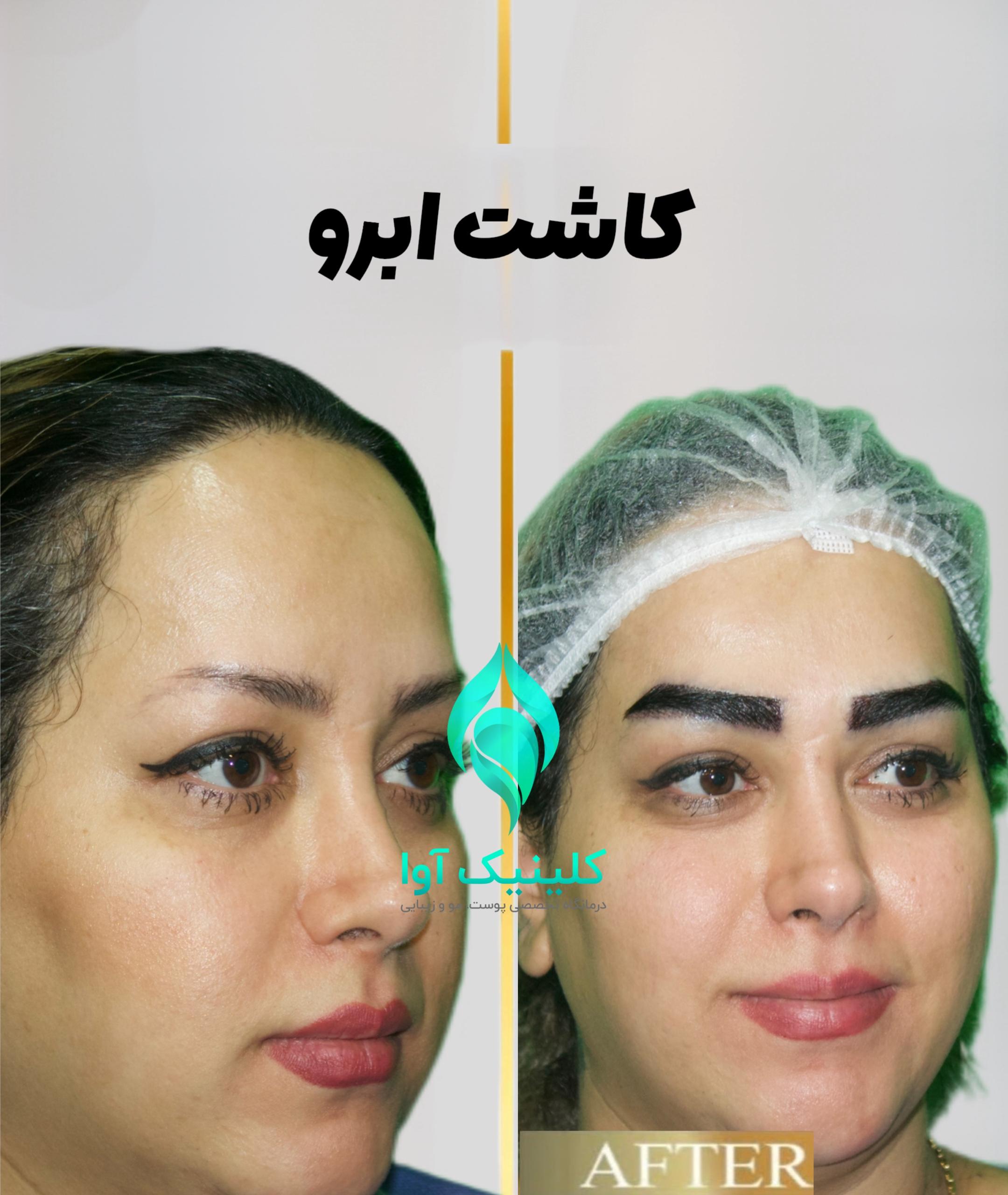 تصویر محیط کلینیک تخصصی پوست و کاشت مو آوا