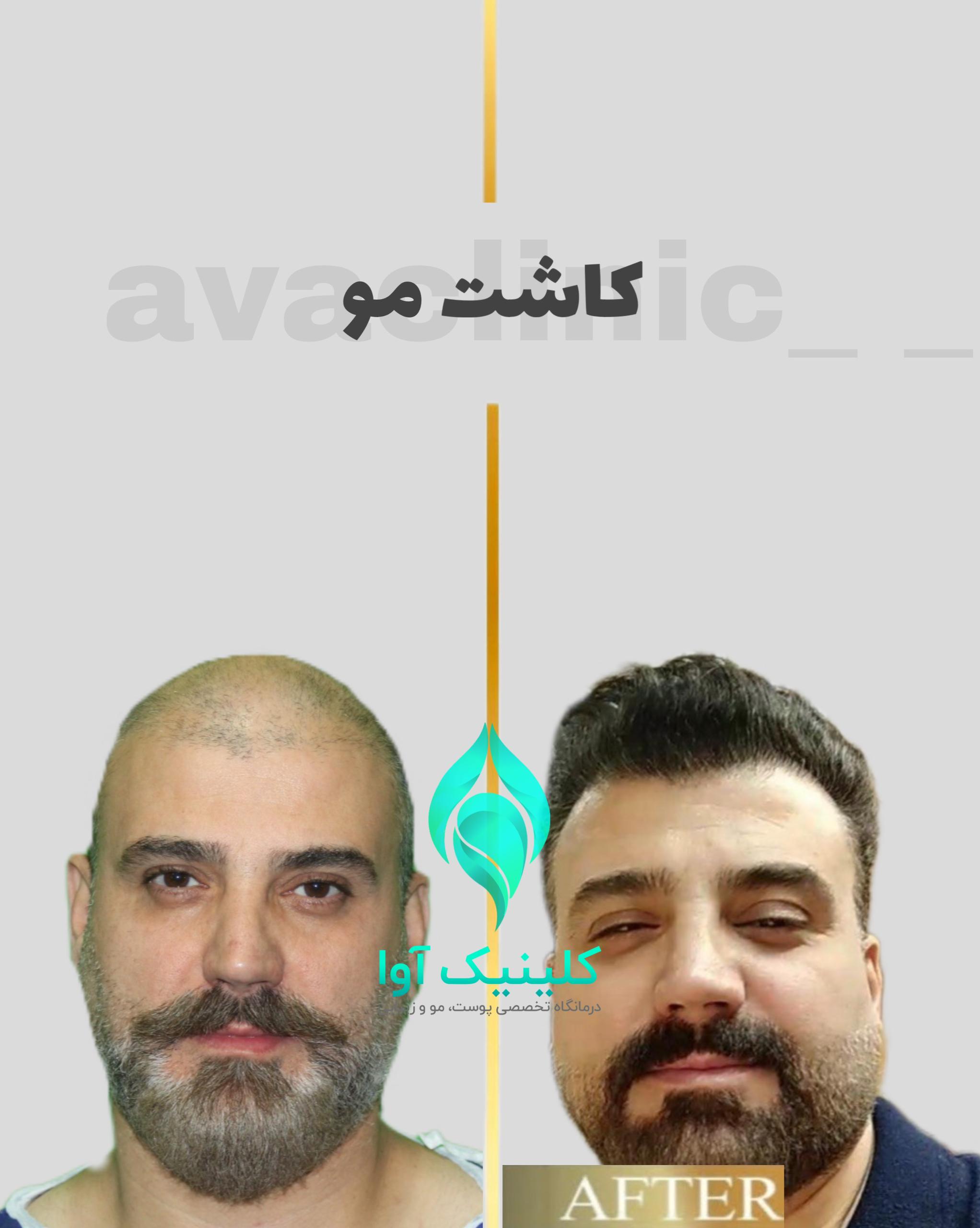تصویر محیط کلینیک تخصصی پوست و کاشت مو آوا