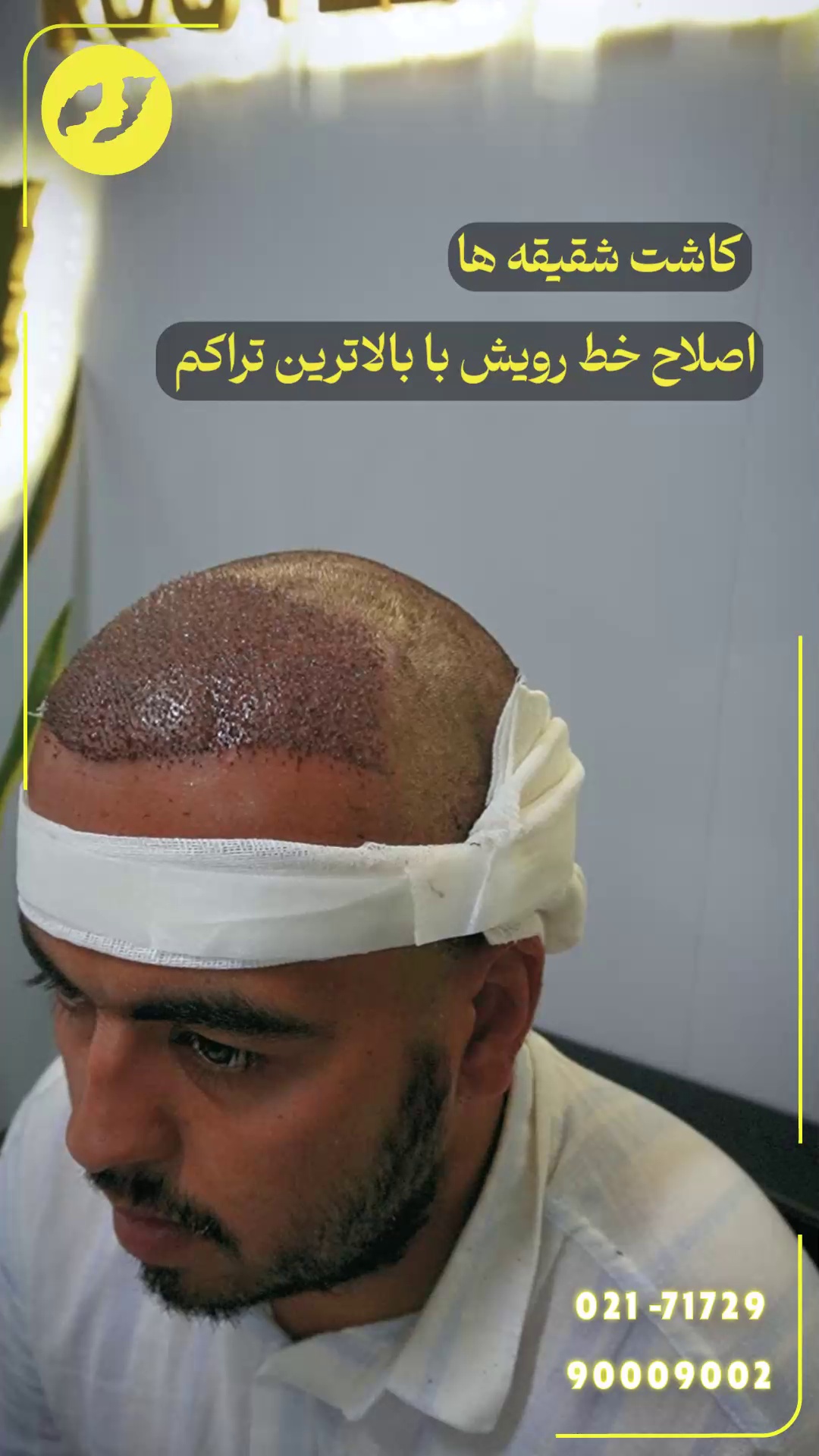 تصویر محیط کلینیک تخصصی کاشت مو و ابرو رویش سبز