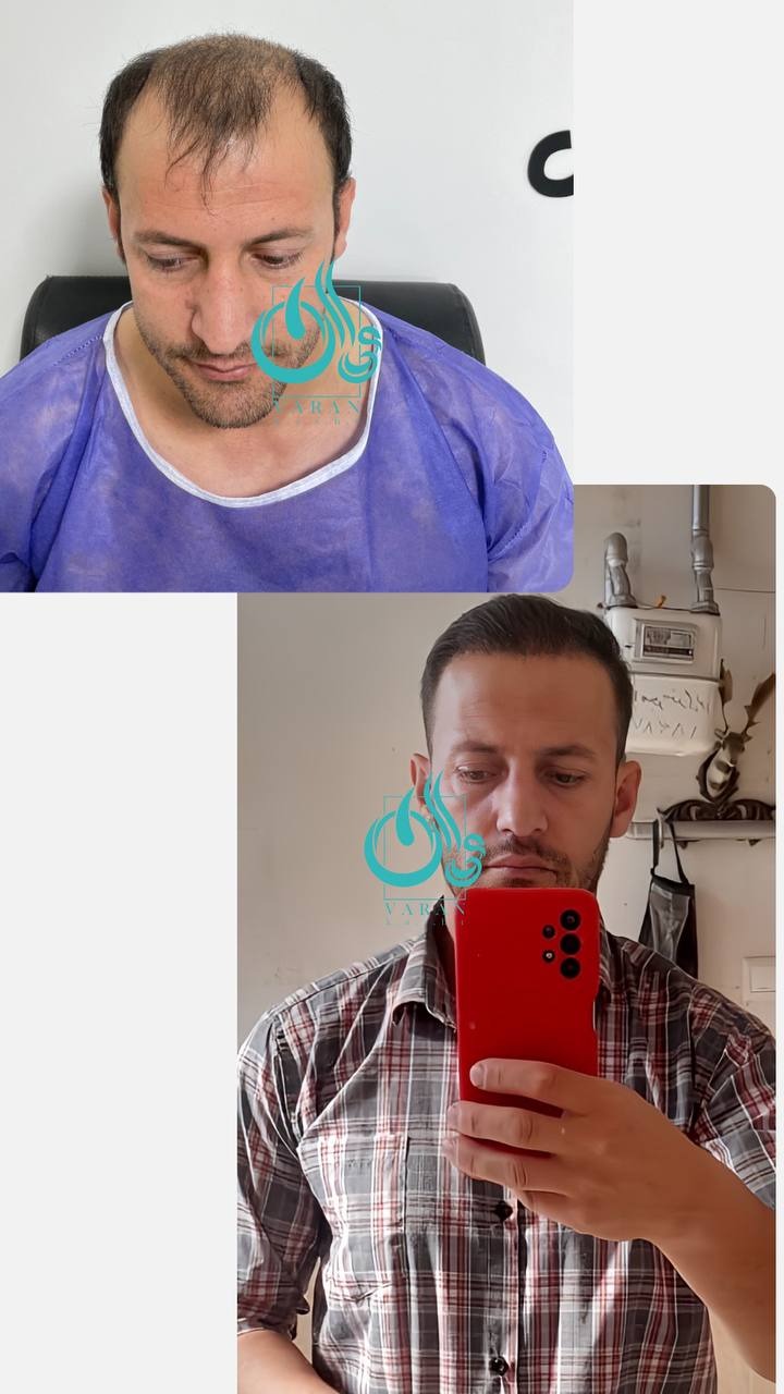 تصویر محیط کلینیک کاشت مو و ابرو واران