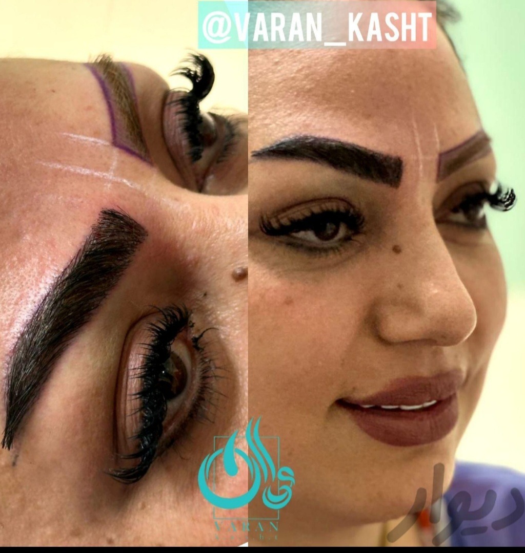 تصویر محیط کلینیک کاشت مو و ابرو واران