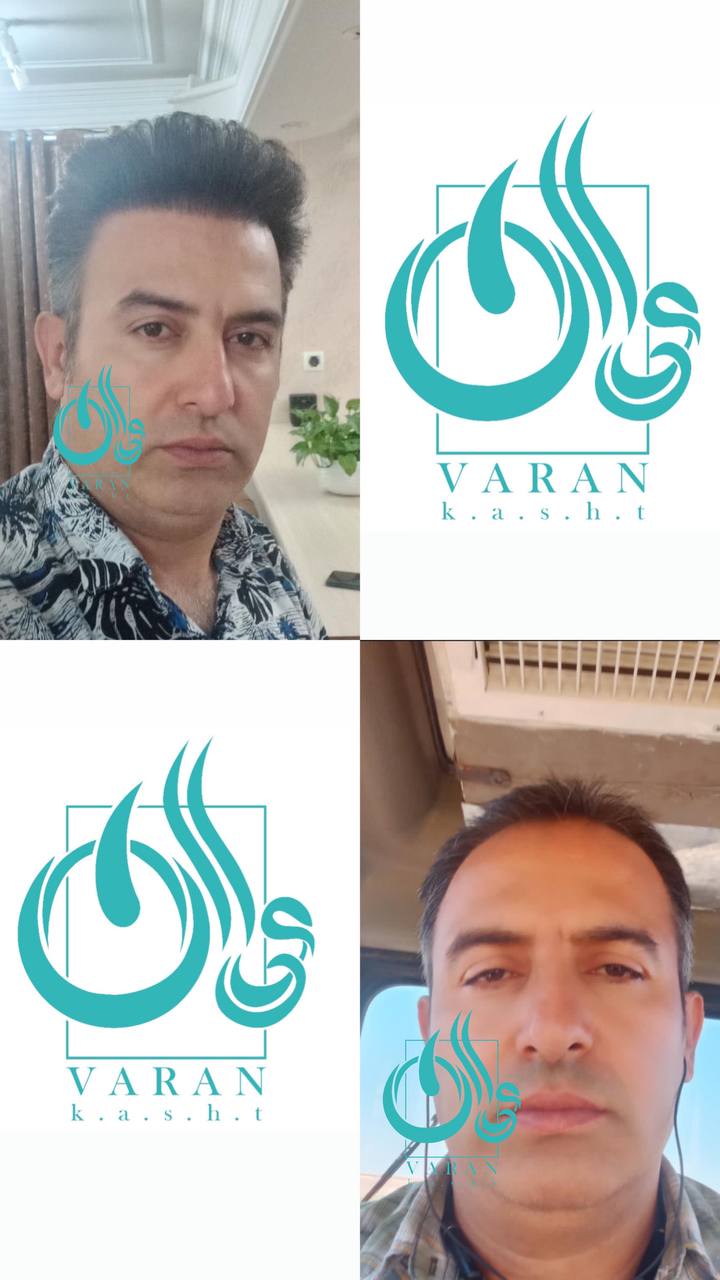 تصویر محیط کلینیک کاشت مو و ابرو واران