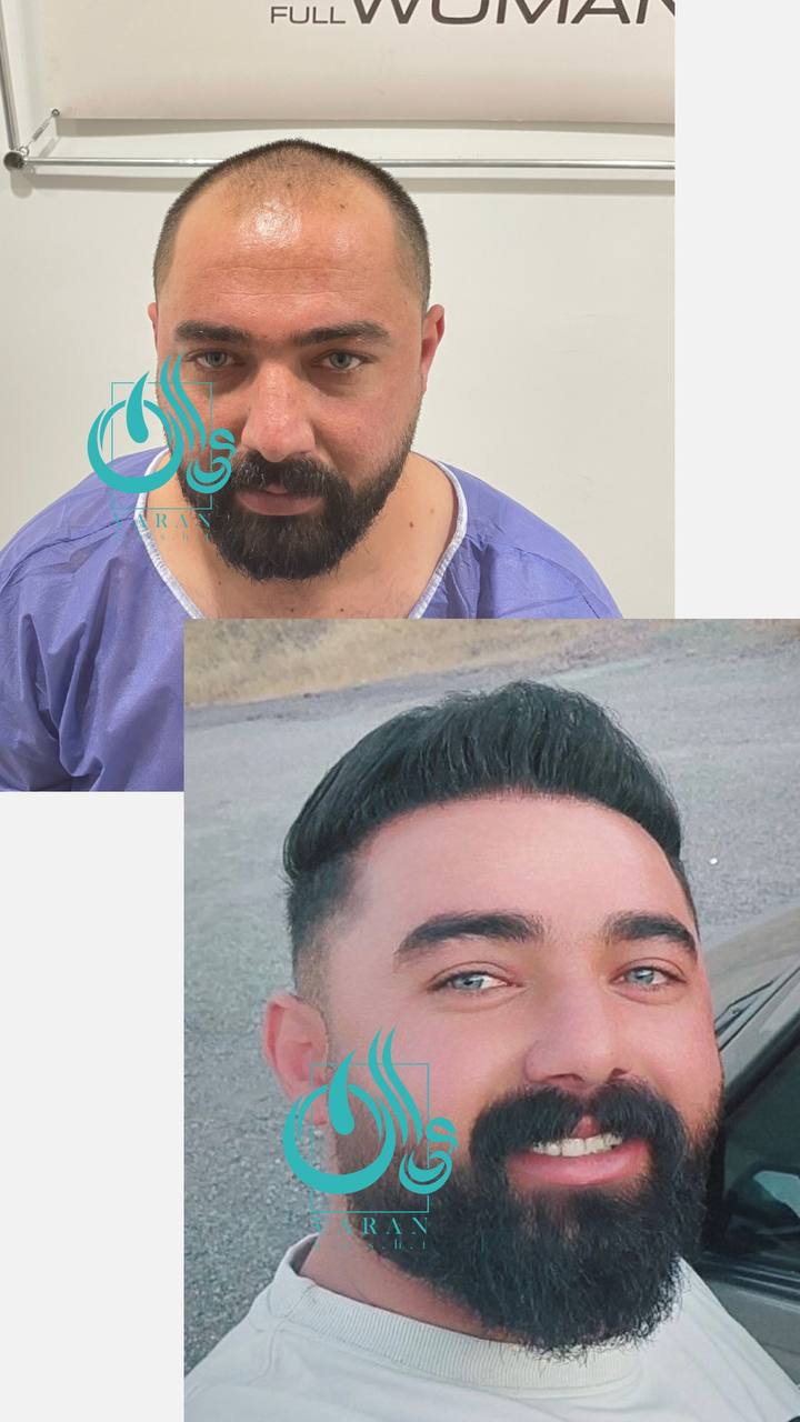 تصویر محیط کلینیک کاشت مو و ابرو واران