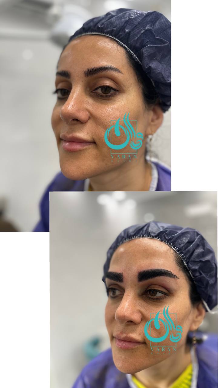 تصویر محیط کلینیک کاشت مو و ابرو واران
