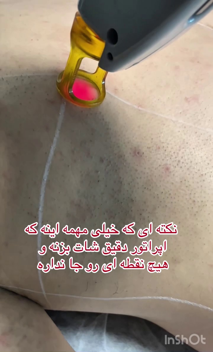 تصویر محیط مرکز تخصصی لیزر موهای زائد ماهرخ