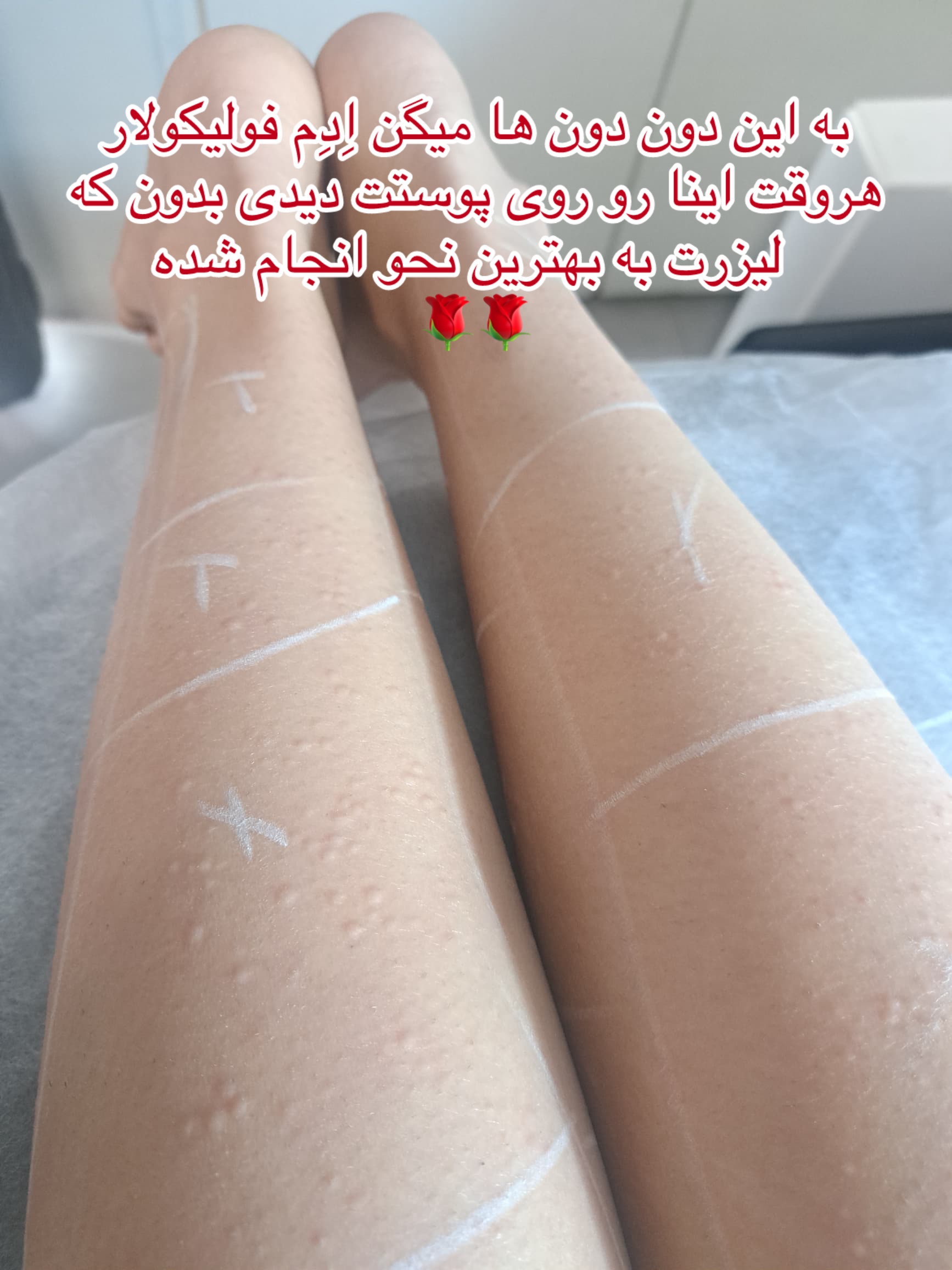 تصویر محیط مرکز تخصصی لیزر موهای زائد ماهرخ