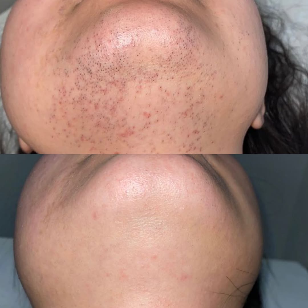 تصویر محیط مرکز تخصصی لیزر موهای زائد ماهرخ