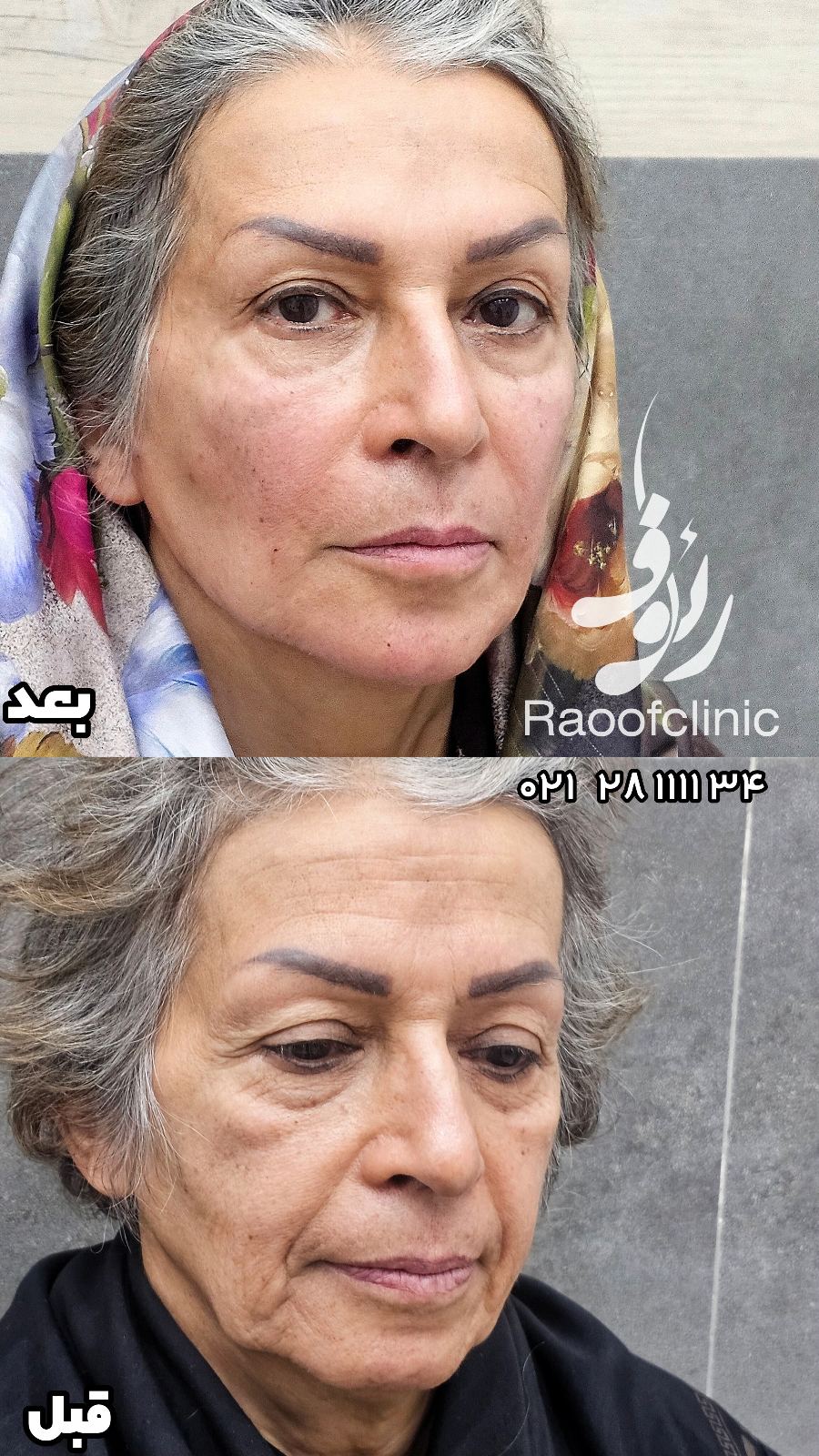 تصویر محیط کلینیک رئوف | پوست، مو، لیزر و جوانسازی