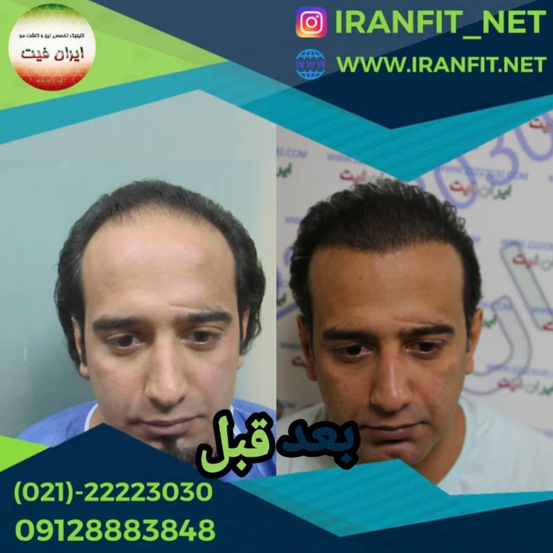 تصویر محیط کاشت مو ایران فیت
