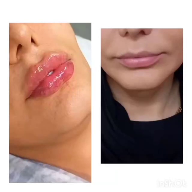 تصویر محیط کلینیک زیبایی پارسیان آلفا
