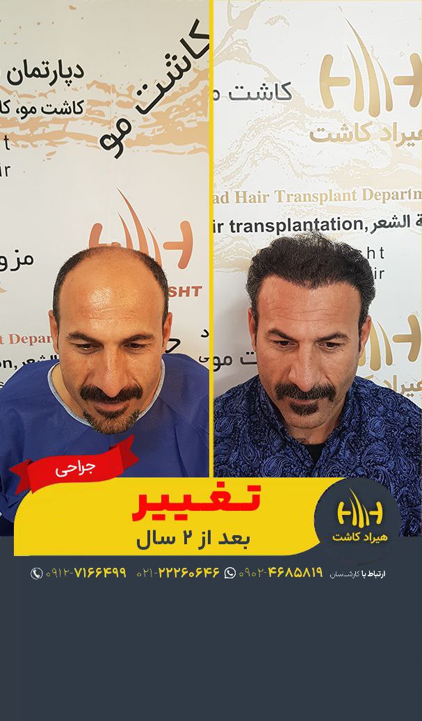 تصویر محیط دپارتمان تخصصی کاشت مو کاشت ابرو هیراد