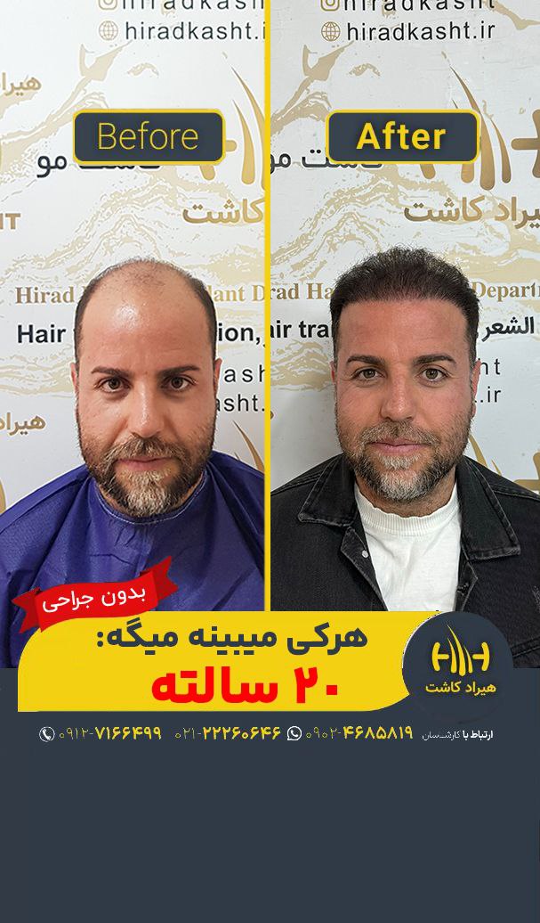 تصویر محیط دپارتمان تخصصی کاشت مو کاشت ابرو هیراد