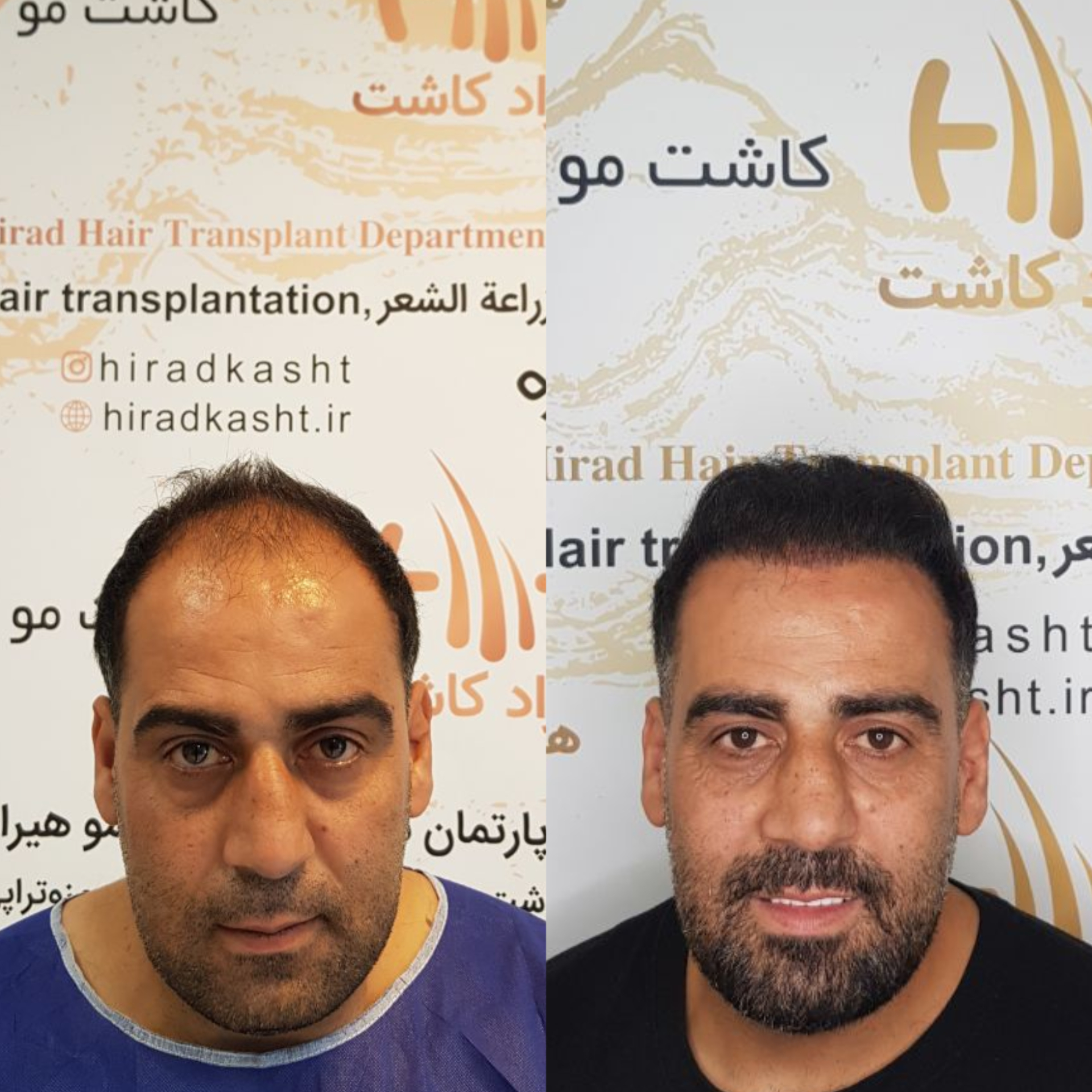 تصویر محیط دپارتمان تخصصی کاشت مو کاشت ابرو هیراد