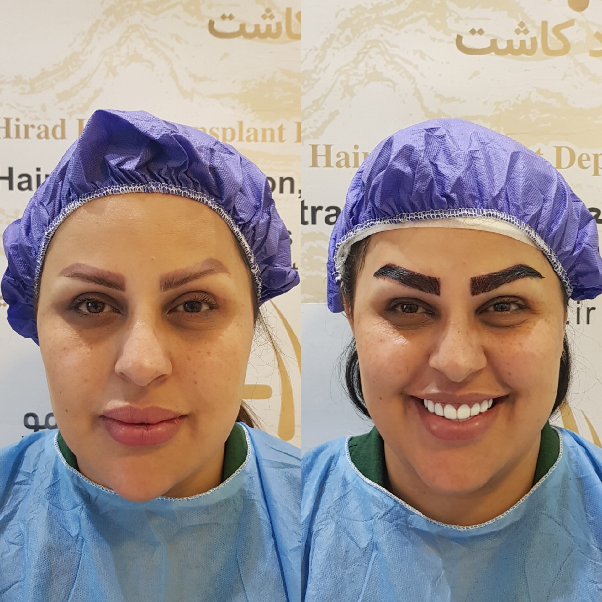 تصویر محیط دپارتمان تخصصی کاشت مو کاشت ابرو هیراد