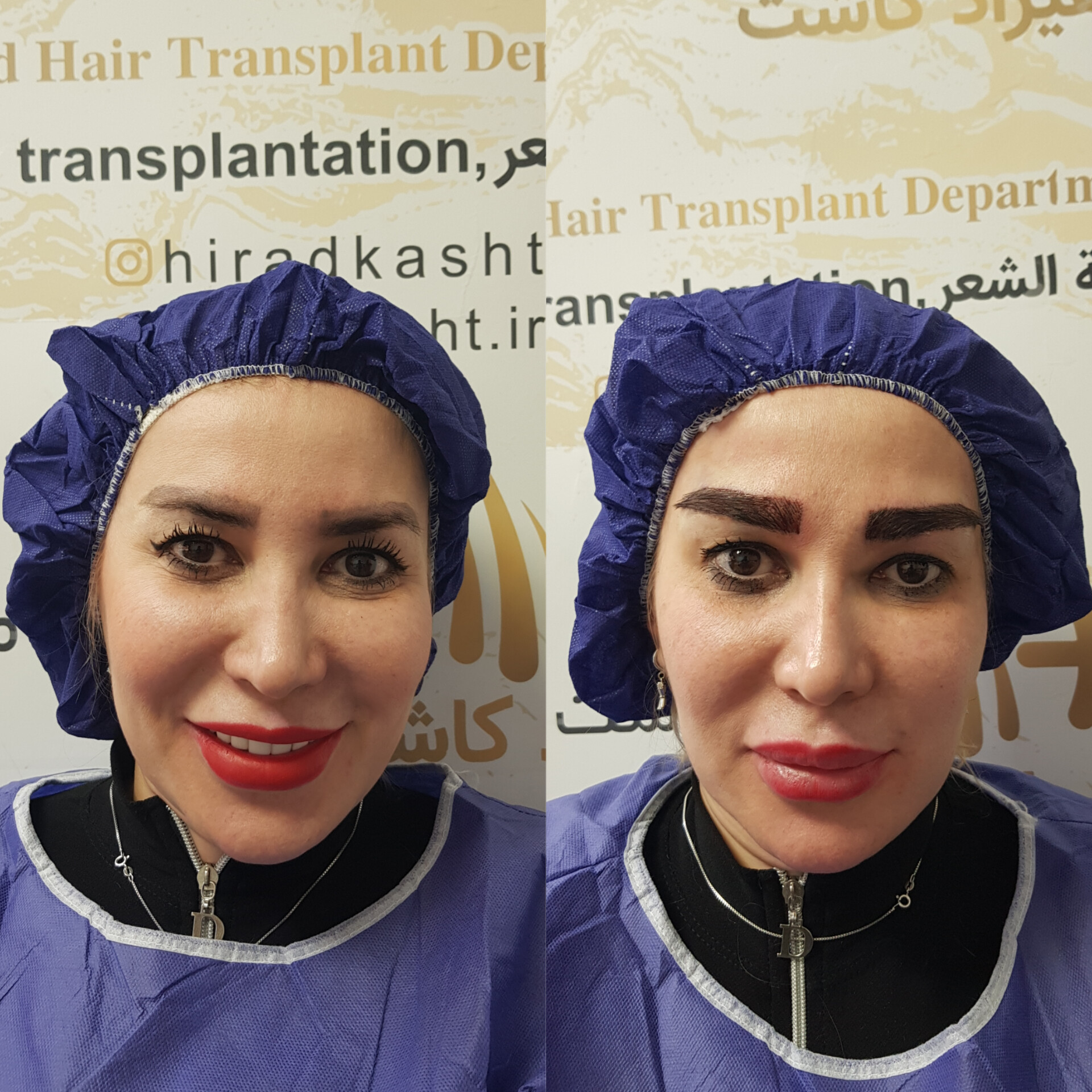 تصویر محیط دپارتمان تخصصی کاشت مو کاشت ابرو هیراد