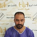 تصویر محیط دپارتمان تخصصی کاشت مو کاشت ابرو هیراد
